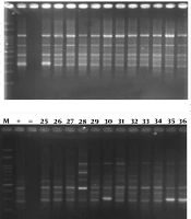 Jundishapur J Microbiol